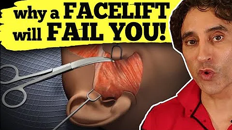 WHY A FACELIFT WILL FAIL YOU // Facelift