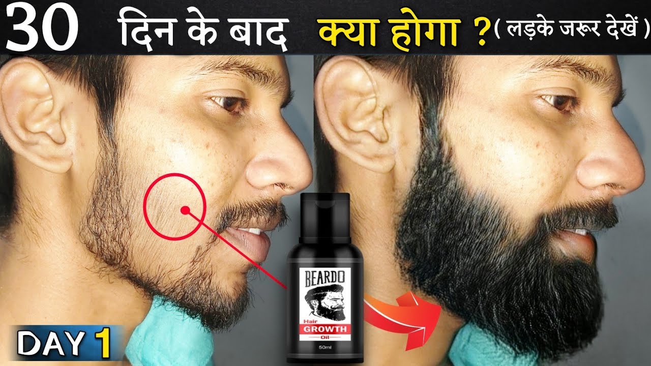 Beardo Hair Growth Oil After30 Days Review Best Beard Oil For Patchy