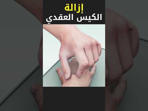 الكيس العقدي في اليد اكسبلور  اكسبلور ترند قصص