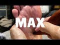 ごりごり足つぼ MAX | ごりごり音の正体とは？Q&A付