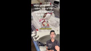 Why Twins Aren’t Always the Same Size
