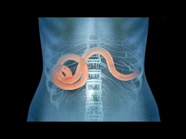 Паразитические черви, гельминты (рассказывает профессор Нелли Тумольская)