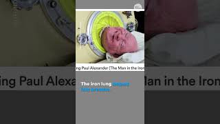 Man Living In Iron Lung After He Contracted Polio In 1952 Dies