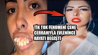 TikTok fenomeni çene cerrahıyla evlendikten sonra bambaşka bir görünüme kavuştu / İnanılmaz Değişim Resimi