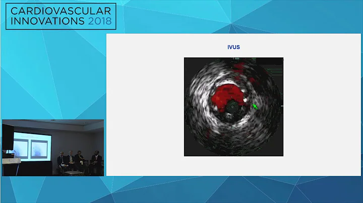 CVI2018 Session: Ad-hoc left main PCI - Michael S. Megaly, MD, MS