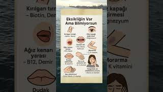 Eksiğin Var Ama Bilmiyorsun Şfet Ğlık Ibilgiler