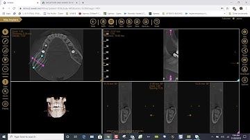 Training: Apteryx XVWeb 3D: Curved Slicing and Pano Extraction