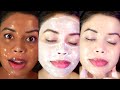 1 Day Challenge - How To Remove Darker Skin &quot;MILK FACIAL&quot;