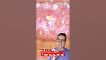 ⚠️ PORE VACUUM Blackhead Removal #shorts