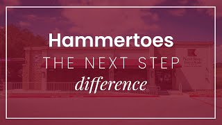 Hammertoes: The Next Step Difference