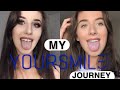 My Your Smile Direct Journey (invisible braces)