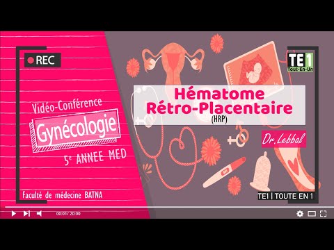 Vidéo: Hématome - Traitement De L'hématome Avec Des Remèdes Et Des Méthodes Populaires