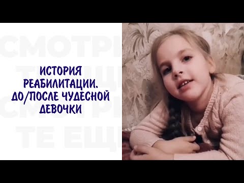 Результаты реабилитации. ДО/ПОСЛЕ ЧУДЕСНОЙ ДЕВОЧКИ