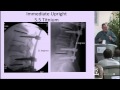 Spinal Instrumentation: Basic Concepts & Biomechanics by Paul Anderson, M.D.