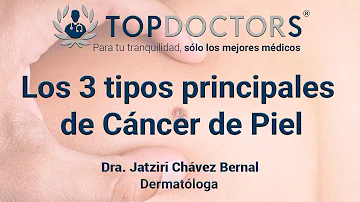 ¿Qué aspecto tiene la fase más temprana del cáncer de piel?