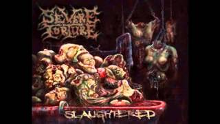 SEVERE TORTURE - Inferior Divinity