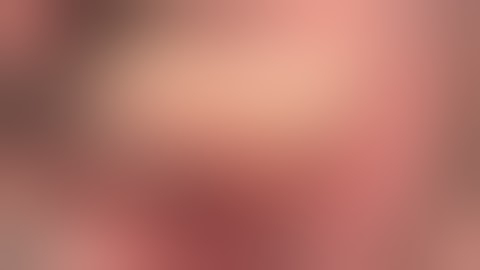 Recession Coverage by Dr Karin Jepsen - dirigido a profesionales sanitarios