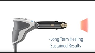 Shockwave Therapy in Bozeman Montana Pro Chiropractic