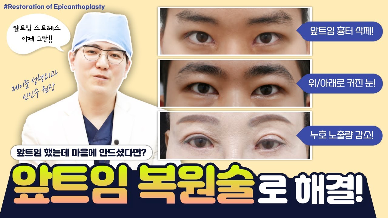 [JAYJUN PHẪU THUẬT THẨM MỸ DA LIỄU] Tôi đã mở khóe mắt nhưng không hài lòng 😥 Vậy thì hãy giải quyết bằng phẫu thuật phục hồi mở khóe mắt!