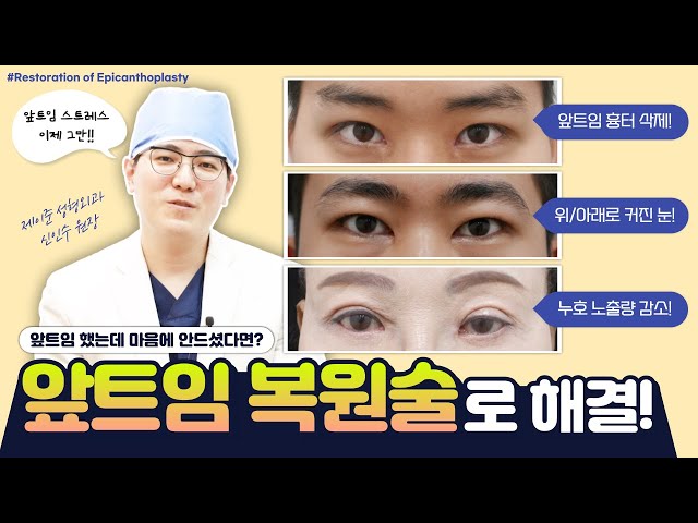 앞트임했는데 마음에 안들어요😥 그렇다면 앞트임 복원술로 해결!