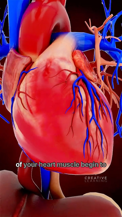 What Really Causes a Heart Attack 🫀 #short #viralvideo - Creativelearning3d