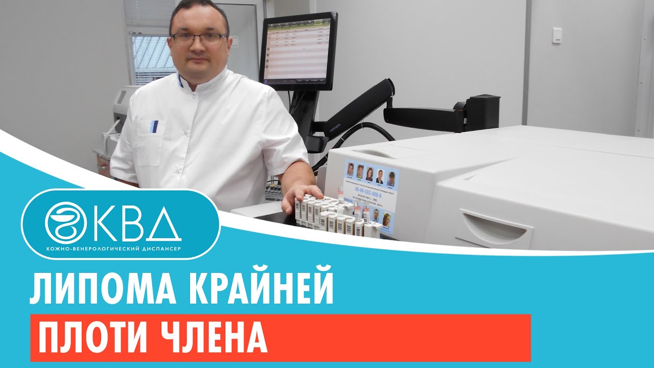 Жировики на члене: опытный дерматовенеролог в Москве.