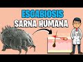 Sarna humana  escabiosis sintomas tratamiento 2023  sarcoptes scabiei  