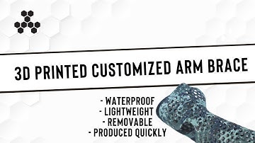 3D Printed Customized Arm Brace