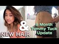 NEW HAIR & 8 Month Tummy Tuck Update