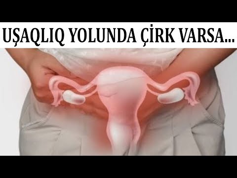 Video: SEMPTOMLAR HAQQINDA ARTIQ DƏRƏK VƏ 