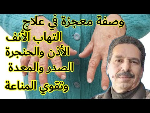 فيديو: نزيف في الأنف: الأسباب والعلاجات