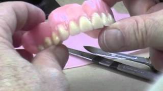 38 Finishing a Complete Denture Waxup