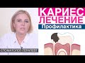 Кариес - основные методы лечения без сверления, со сверлением. Профилактика кариеса. Метод Icon