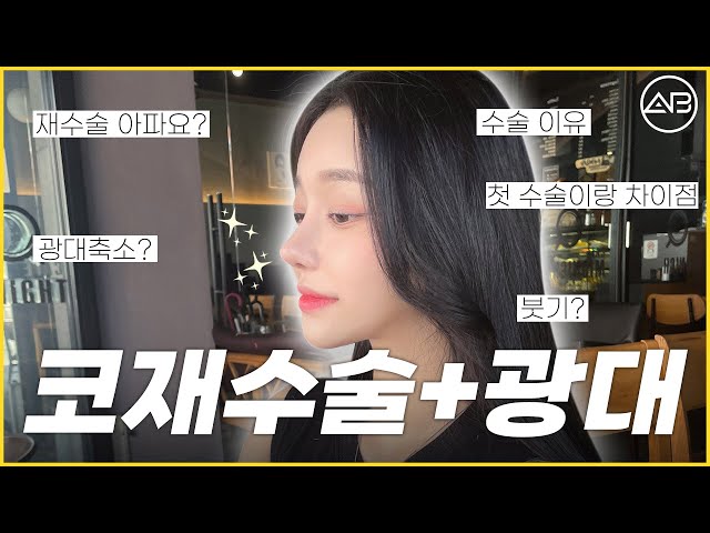 [코재수술+광대축소] 급이 다른 외모 클라쓰 | 3달차 후기 | 에이비성형외과