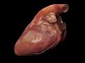 Medical animation  heart