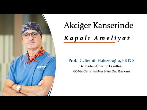 Akciğer Kanserinde Kapalı Ameliyat - PROF. SEMİH HALEZEROĞLU