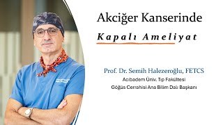 Akciğer Kanserinde Kapalı Ameliyat - Prof Semi̇h Halezeroğlu