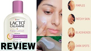 Lacto Calamine face Lotion Review How To Use lacto Calamine Lotion #lactocalaminelotion