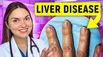 12 Tanda Penyakit HATI yang Bisa Anda Lihat: Dokter Menjelaskan