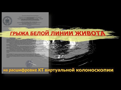 ГРЫЖА белой линии живота   симптомы проявления на РАСШИФРОВКЕ КТ виртуальной колоноскопии