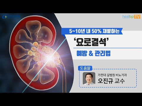 5~10년 내 50% 재발하는 ‘요로결석’ 예방 & 관리법