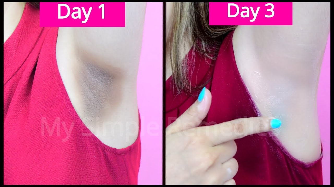 Just 1 Use Will Make Your Underarms Bright Smooth And Soft Underarms Armpit Treatment Youtube 