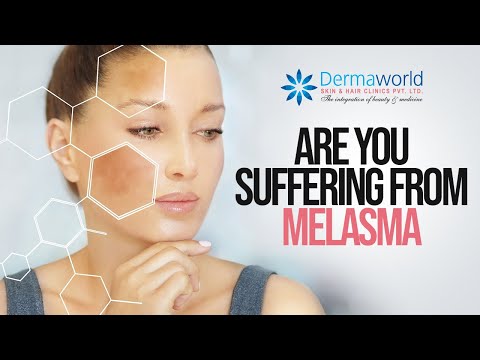 Video: Försvinner melasma av sig själv?