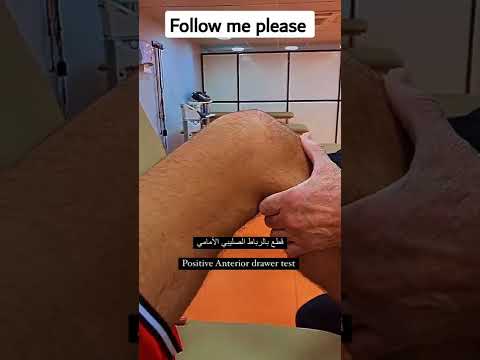 هو احد الاختبارات لثبات الرباط الصليبي بمفصل الركبة
