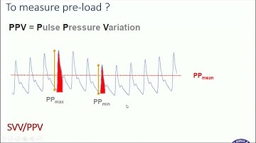 Siêu âm thăm dò huyết động - BS. CK2. Nguyễn Xuân Ninh