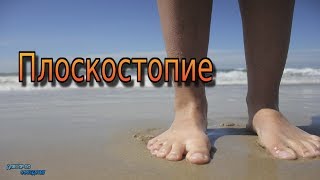 Плоскостопие / FLAT FEET