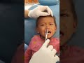 Viral massive worm on kid nose shorts worm viral