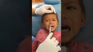 Viral Massive Worm on Kid Nose #Shorts #Worm #Viral