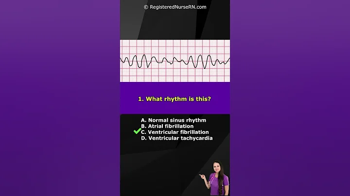 ECG Rhythm Pop Quiz: Can You Identify These EKG Rhythms? #shorts