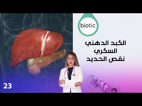الكبد الدهني السكري نقص الحديد م٤  الحلقة ٢٣